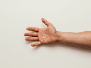 כירורגיה של כף היד